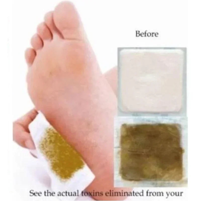 HMsmart®  Kinoki Detox Foot Patches| Kinoki Ginger & Wormwood Detox Foot Patches - HMsmart